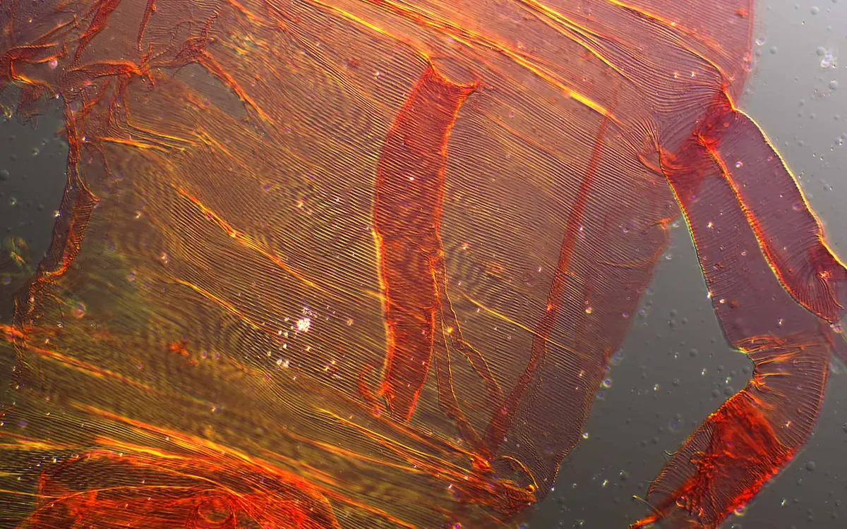 Microscopic close-up of flea body showing detailed structure